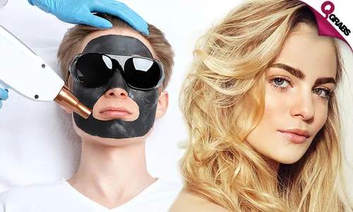 Q-Switch Laser Treatment for Carbon Peel, Hair Bleaching & More!